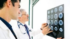 5 Kondisi yang Mengharuskan Kita Mengunjungi Dokter Spesialis Saraf
