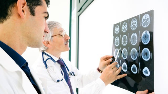5 Kondisi yang Mengharuskan Kita Mengunjungi Dokter Spesialis Saraf