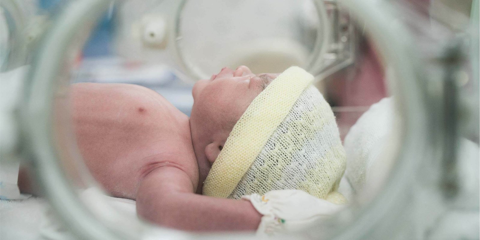 Penyebab dari Bayi Lahir Prematur